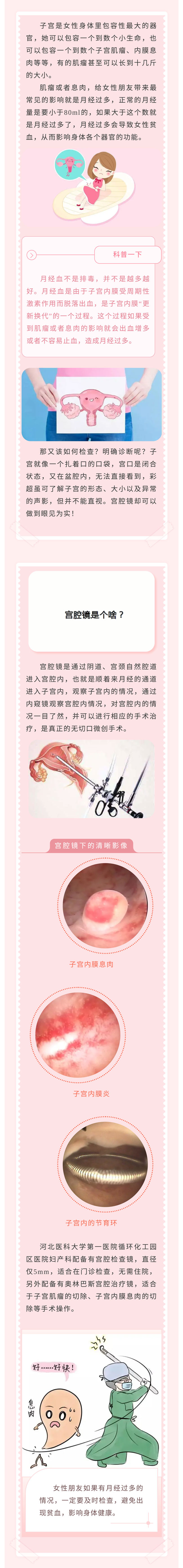 月經(jīng)量增多！怎么回事？——小小“宮腔鏡”，一探究竟！.jpg